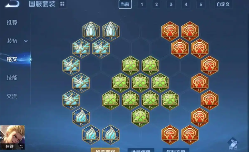 王者荣耀新狂铁最强出装是什么